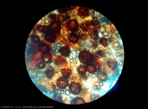 Observation au microscope de pycnides d'un <i>Phoma</i> sp. présentes sur une zone nécrosée d'une feuille de taro atteinte de criblure.