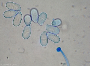 Aspect de plusieurs conidies hyalines et bicellulaires situées à proximité de l'extrémité d'un conidiophore de  <i><b>Trichothecium roseum</b></i>. (moisissure rose)