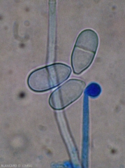 Aspect de quelques conidies hyalines et bicellulaires situées à proximité de l'extrémité d'un conidiophore de  <i><b>Trichothecium roseum</b></i>. (moisissure rose)