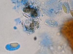 Aspect au microscope photonique d'ascospores  d'<b><i>Erysiphe necator</i></b>. (oîdium)