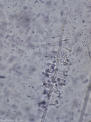 Botryosporium20