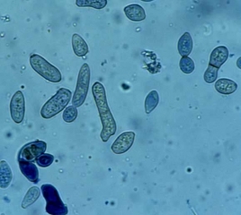 De nombreuses conidies irrégulières, parfois cloisonnées et brunâtres, sont observées sur le limbe. <b><i>Passalora fulva</i></b> (cladosporiose, leaf mold)