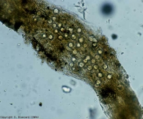 De très nombreuses oospores se sont formées dans les cellules du cortex de cette racine altérée <b><i>Pythium</i> sp.</b> (fonte des semis, pourritures racinaires et basales, damping-off, foot and root rot)