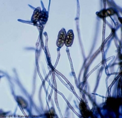 On distingue quelques conidies brunes et pointues au milieu de conidiophores bruns et cloisonnés (130-200 x 4-7 µm). <b><i>Stemphylium solani</i></b> (stemphyliose, grey leaf spot)