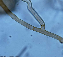 Un mycélium brun et cloisonné progresse à la surface des tissus lésés. <b><i>Thanatephorus cucumeris, Rhizoctonia solani</i></b> (Rhizoctone brun, <i>Rhizoctonia</i> basal stem canker)