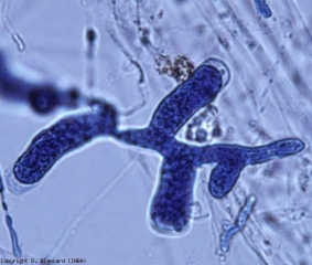 Sporanges filamenteux de <b><i>Pythium aphanidermatum</i></b>.