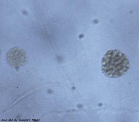 Sporange filamenteux de <b><i>Pythium </i>sp.</b> renfermant plusieurs zoospores.