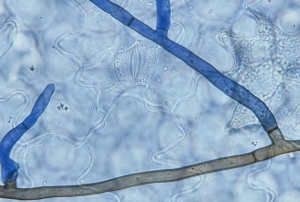 Le mycélium de <b><i>Thanatephorus cucumeris</i></b> (<i>Rhizoctonia solani</i>, "damping-off", "bottom rot") se caractérise par son aspect robuste, une largeur comprise entre 5 et 15 µm et une coloration brun foncé. On note également une légère constriction au niveau des ramifications latérales ainsi que la présence de cloisons.