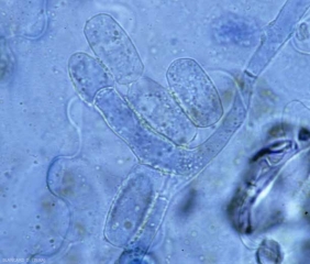 <b><i>Golovinomyces cichoracearum</i> var. <i>cichoracearum</i></b> (oïdium, "powdery mildew") dans sa forme imparfaite produit couramment des chaînes de conidies hyalines, cylindriques à doliformes (25-45 x 14-26 µm), situées à l'extrémité de courts conidiophores.