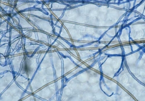 <b><i>Thanatephorus cucumeris</i></b> (<i>Rhizoctonia solani</i>, "damping-off", "bottom rot") se caractérise par un mycélium brun, cloisonné, présentant des constrictions à la base des ramifications.