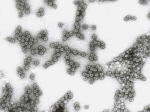 Particules virales isométriques d'environ 29 nm de diamètre. <b>Virus de la mosaïque du concombre</b> (<i>Cucumber mosaic virus</i>, CMV)