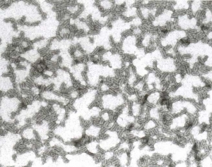 Particules virales polyédriques à bacilliformes de 18 nm de diamètre. <b>Virus de la mosaïque de la luzerne </b>(<i>Alfafa mosaic virus</i>, AMV)