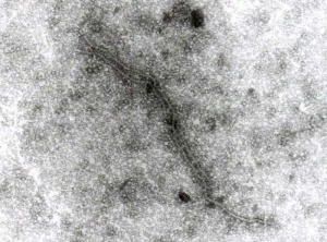 Les particules du <b>virus de la pseudo-jaunisse de la betterave </b>(<i>Beet pseudo-yellows virus</i>, BPYV) sont flexueuses et filamenteuses.