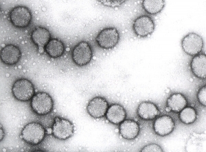 Particules virales sphériques de 85 nm de diamètre. La présence d'une enveloppe lipidique leur confère un aspect particulier. <b>Virus de la maladie bronzée de la tomate</b> (<i>Tomato spotted wilt virus</i>, TSWV)