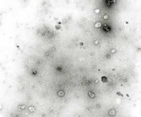 Les particules du <b><i>Mirafiori lettuce big-vein virus</i></b>
(MLBVV, virus des grosses nervures de la laitue) sont difficilement observables en microscopie électronique.