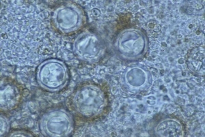 oospores_bremialactucae