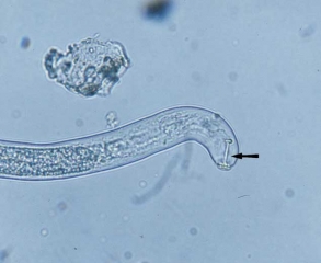 nematode419