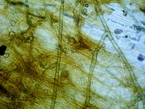 Filaments mycéliens cheminant à la surface du limbe d'une feuille de salade.<b><i>Thanatephorus cucumeris</i></b> (<i>Rhizoctonia solani</i>, pourriture basale, bottom rot)