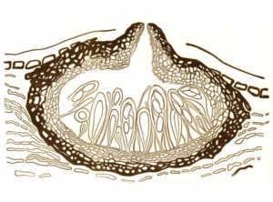 Coupe dans un périthèce de <b><i>Botryosphaeria obtusa</i></b>, champignon impliqué dans la maladie du BDA (black dead arm).