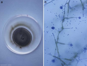 phaeomoniella