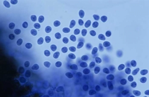 Les pycniospores du champignon responsable du <b>black rot</b>, sont incolores et ovoïdes.