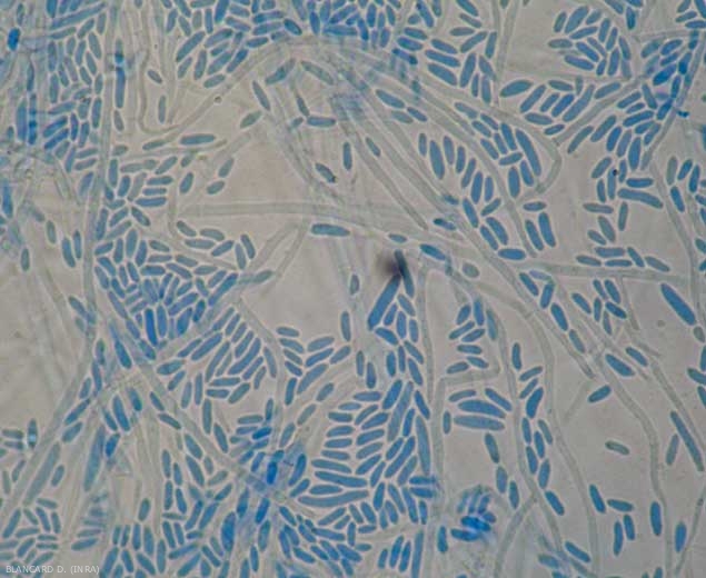 Aspetto del micelio e delle conidie di <b><i>Verticillium dahliae</i></b> (verticilliosi, <i>Verticillium</i> wilt).