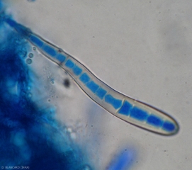 Questa conidia di <b><i>Coynespora cassiicola</b></i> è allungata, hyalina e presenta più di 10 pseudo-partizioni. (corynesporiosi)