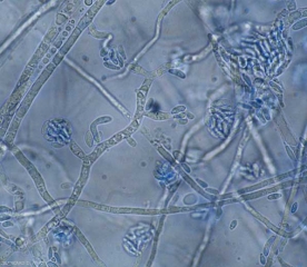 Giovani conidiofori di <b><i>Fusarium oxysporum</i> f. sp. <i>lycopersici</i> </b> formando microconidi unicellulari. <b>Fusariosi vascolare (<i>Fusarium</i> wilt)</b>