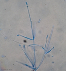 Primo piano su alcuni conidiofori di <b><i>Verticillium dahliae</i></b> alla cui estremità sono ancora presenti conidi ellissoide di questo fungo.(verticilliosi, <i>Verticillium</i> wilt).