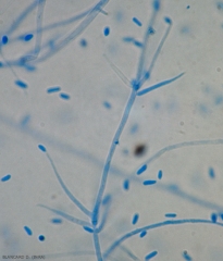 Dettaglio di un conidioforo di <b><i>Verticillium dahliae</i></b>. Una conidia è ancora presente alla sua estremità. (verticilliosi, <i>Verticillium</i> wilt).