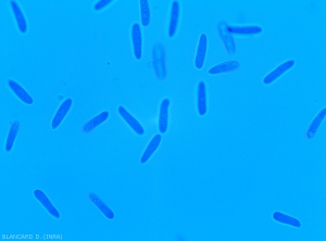 Détail de conidies de <i><b>Colletotrichum</i> sp.</b> cylindriques. (anthracnose)