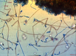 Observation microscopique de sporulations de <i>Cladosporium colocasiae</i> : les conidie, plus claires que les conidiophores, se colorent partiellement au "bleu coton". Notons les conidies de formes variées, en courtes chainettes. Certaines sont cloisonnées.
