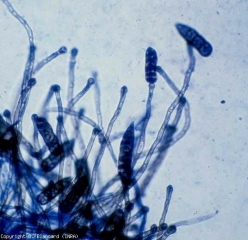 Di colore oliva e con apice rigonfio, questi conidiofori sono settati e misurano 75-300 µm x 3-5,5 µm.  Anche i conidi sono appuntiti ma sono più lunghi di quelli di <i> Stemphylium solani </i>.  <b> <i> Stemphylium lycopersici </i> </b>