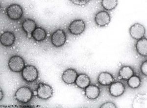 Particelle virali sferiche di 85 nm di diametro.  La presenza di un involucro lipidico conferisce loro un aspetto particolare.  <b> Virus della macchia fogliare di pomodoro </b> (<i>Tomato spotted wilt virus</i>, TSWV)