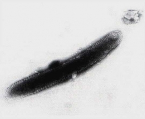 <b><i>Pectobacterium carotovorum</i> subsp. <i>carotovorum</i></b> è un batterio Gram -, a forma di bastoncino e dotato di flagelli periti (marci batterica, <i>bacterial stem rot and fruit rot</I>).