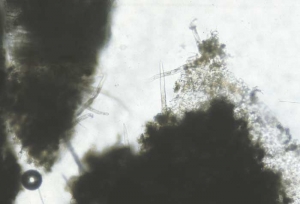 Quando um tecido danificado é dissecado, pode-se observar vários nematoides foliares. <i><b>Aphelenchoides ritzemabosi</i></b> (Doença da folha quadriculada). 
