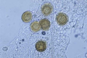Os oósporos marrons podem ser observados em tecidos alterados, eles asseguram a reprodução sexual do fungo. <b><i>Peronospora hyoscyami</i> f.sp. <i>tabacina</i></b>a (mofo azul do tabaco, míldio)