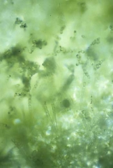 A massa branca pulverulenta é, em fato formada por micelio do fungo e pela profusao de coniodoforos e conidios, formados em cadeias. <i>Golovinomyces cichoracearum</i> var. <i>cichoracearum</i> (oidio) 
