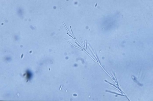 Conidioforos de <b><i>Verticillium dahliae</i></b> (Murcha de Verticillium ) sao ramificados, produzindo conidio hialino, unicellular de formato ovoide.