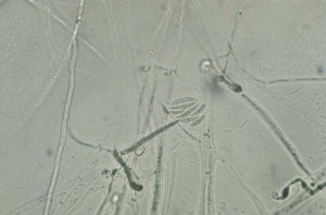 <b><i>Fusarium oxysporum </i>f. sp. <i>nicotianae</i> </b> (mucha de fusarium) produz conidioforos curtos, curvos, elongados com macroconidia multicellular. Tambem produz macroconidia uniceluar e clamidosporos. 

