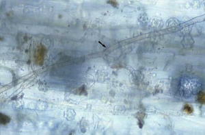 Micélio marrom e ramificado de <i><b>Rhizoctonia solani</b></i> é facilmente observado neste sistema radicular.