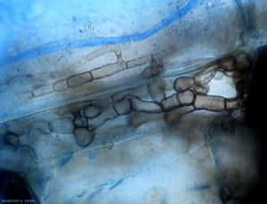 Aparência ao microscópio fotônico do micélio formado no córtex das raízes do tomate por <b><i>Colletotrichum coccodes</i></b>.