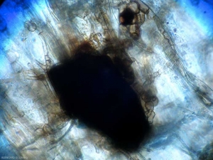 Aparência ao microscópio fotônico de um microescléo de <b><i>Colletotrichum coccodes</i></b>.