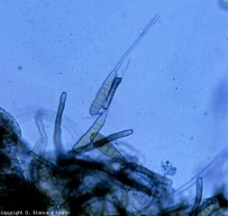 Conidiophores e conidies de <b><i>Alternaria tomatophila</i></b> são observáveis sob um microscópio fotônico em tecidos lesados. Os esporos deste fungo, pluricelulares e alongados, são solitários e providados de uma extensão hialina filiforme. <b>Alternariose (early blight)</b>
