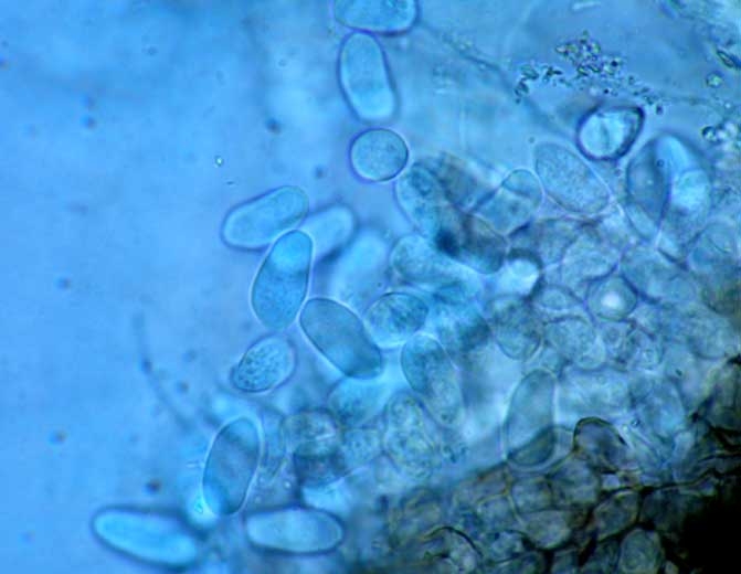 Hyaline, ellipsoid to oval conidia measuring 16-29 x 6-9 µm could be extracted by pressing a pycnidia.  <b> <i> Macrophomina phaseolina </i> </b>