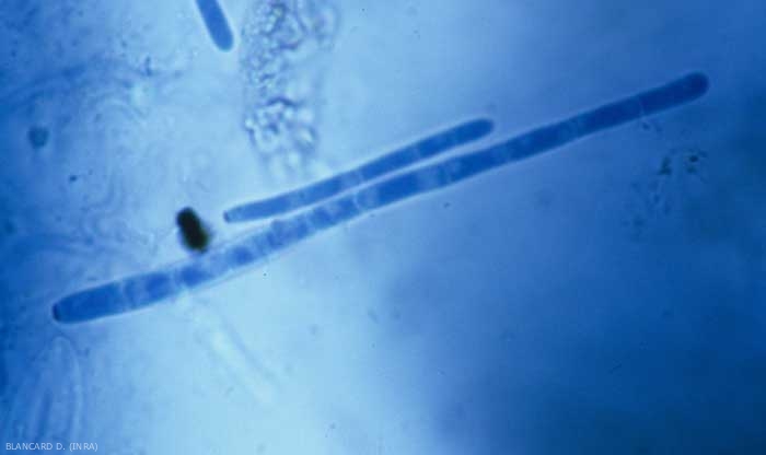 The conidia formed at the end of the conidiophores are hyaline and cylindrical.  They show from 1 to 18 partitions and measure from 11 to 170 µm in length.  <b> <i> Cercospora longissima </i> </b> (Sigatoka, "<i> cercospora </i> leaf spot")