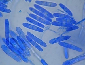 <b> <i> Cylindrocarpon liriodendri </i> </b> forms conidiophores carrying at their end cyclindrical and sometimes curved conidia, presenting more or less partitions.