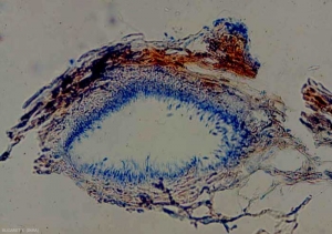 Inside this pycnidia, we can clearly see the many conidiophores which line it;  conidia are formed at their ends.  <b> <i> Phomopsis viticola </i> </b> (excoriose)