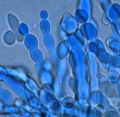 Detail of the formation of conidia in a <b> <i> Monilia </i> sp.  </b> (moniliosis)