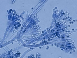 Conidiophores  of <i><b>Penicillium expansum</b></i> . (rot Penicillium)
